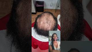 transformation 😍 canada 4c hairstyle france canada trending viralvideo hairgrowth cheveux [upl. by Ahsilac]