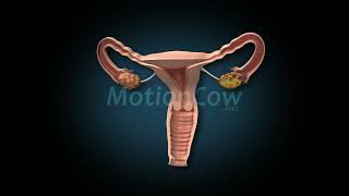 Uterus Section 3D Model [upl. by Berey]