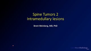 Spine tumors 2 – Intramedullary lesions [upl. by Urbannal]