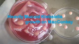 Heavily Mucoid Lactose Fermenting colony of Klebsiella pneumoniae [upl. by Asilla]