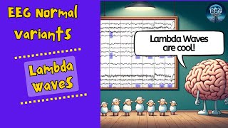 Lambda Waves  Normal EEG Basics [upl. by Notrom]