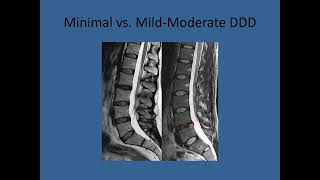 How to read an MRI  MRI image Interpretation [upl. by Er]