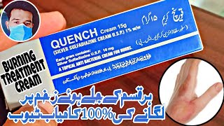 Burning Treatment jale Huwe Zakham or unke Nishant Khatam 100 Quench Cream Benefits UrduHindi [upl. by Anisor]