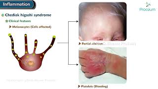 Phagocytosis Of Microorganisms And Tissue Debris  Pathology Lectures [upl. by Earised]