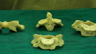 Vertebrae  How to differentiate them [upl. by Eisle]