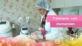 PEELING DERMAMELAN TRATAMENTO PARA MELASMA E CICATRIZ DE ACNE [upl. by Lottie844]