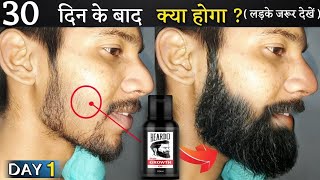 Beardo Hair Growth Oil After 15 Days Review  Best Beard Oil For Patchy Beard in India 2024 [upl. by Tseng]