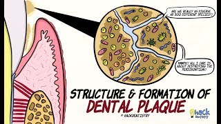 Dental Plaque Structure and Formation [upl. by Oile]