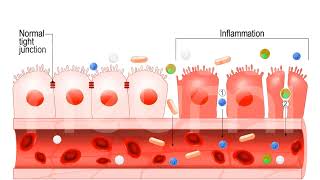 Los 10 Principales Problemas que impiden la Absorción de Nutrientes en el sistema intestinal [upl. by Ardnassac]