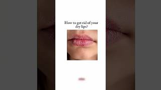 How to get rid of your dry lips 👄aesthetic aestheticglow skincareproducts [upl. by Dammahom216]