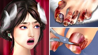 ASMR Ingrown Toenail Removal and Deep Foot Massage for Ballet [upl. by Lesoj589]