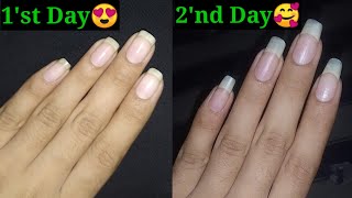 How to Grow Nails in 2 Days  How to Grow Nails Fast [upl. by Gnoz]