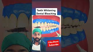 Teeth whitening Process 3D Animation Bleaching yt shorts ytshorts animation teethwhitening [upl. by Airdnazxela]