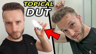 Topical Dutasteride  4 Things We Don´t Know and Why I use it TD Discord Group [upl. by Enirhtac122]