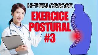 HYPERLORDOSE LOMBAIRE  EXERCICE POSTURAL 3 [upl. by Eerased]