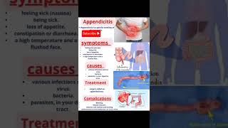 Appendicitis hospital nursing injection science humananatomy [upl. by Selda]