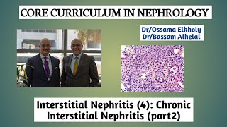 Interstitial Nephritis4 Chronic Interstitial Nephritis part 2 DrOssama Elkholy [upl. by Samuela]