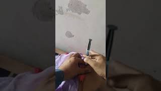 hip injection video ll buttocks funny injection vlog ll intramuscular injection procedure 💉 hip vlog [upl. by Meehar57]