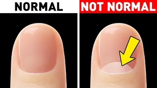 Look at Your Nails and Youll Realize How Rare Your Body Is [upl. by Ardnoed]