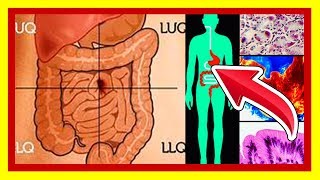 ✔ Significado de los Gruñidos en el Estomago  Causas de Ruidos INTESTINALES [upl. by Aivizt]