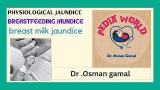 Physiological jaundice l Breastfeeding amp Breast milk jaundice [upl. by Admama]