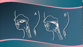 Chapter 3  Understanding Cleft LipPalate Physiology [upl. by Ardnazil]