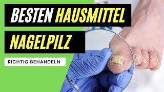 ✅ Nagelpilz behandeln  Die BESTEN Hausmittel zum entfernen [upl. by Htrahddis]