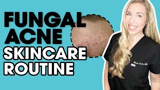 Fungal Acne Skincare Routine  Musthave Products  The Budget Dermatologist [upl. by Vada118]