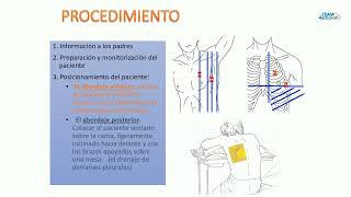 Toracocentesis y Sonda Endopleural [upl. by Etna]