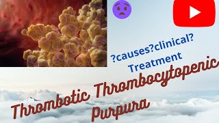 Thrombotic Thrombocytopenic PurpuraTTPIs TTP an autoimmune diseaseReviewusmleneetpgplabfmge [upl. by Ahsyas326]