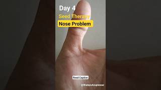 Day 4 Seed Therapy  Easy seed therapy for Nose Problem  Shatayu Acupressure seedtherapy shorts [upl. by Epul390]