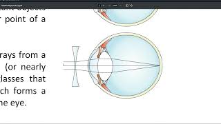 Medical Physics Lab  Eye  مختبر فيزياء العين [upl. by Godderd]