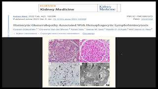 Renal Pathology Rounds 62023 [upl. by Zelazny483]