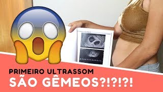 Meu primeiro ultrassom e uma grande surpresa  Lorenna e os Gêmeos [upl. by Otir792]