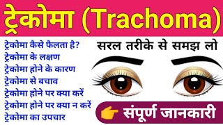 Trachoma Disease in Hindi  Trachoma Causes Symptoms Treatment Prevention  ट्रेकोमा रोगबीमारी [upl. by Enomyar428]