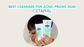 CLEAR ACNE WITH CETAPHIL DRUGSTORE CLEANSERS [upl. by Putnem]