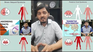 Spinal Cord Injuries  NeuroAnatomy  Rules Facts Clinical Features  Muhammad Kamran Ameer [upl. by Andriana]