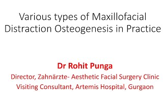 Types amp Uses of Distraction Osteogenesis in Maxilla and Mandible [upl. by Naid]