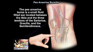 Pes Anserine Bursitis  Everything You Need To Know  Dr Nabil Ebraheim [upl. by Shana]