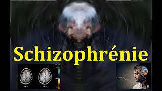 Schizophrénie les symptômes et la physiopathologie explication neurobiologique [upl. by Rhtaeh490]