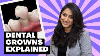 Dental Crowns amp Caps Explained Are They Really Necessary After A Root Canal When Can You Avoid [upl. by Gordy]