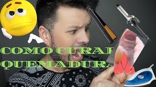 Como curar quemaduras de plancha remedios caseros [upl. by Rebeka]