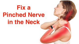 Fix a Pinched Nerve in the Neck With FREE Exercise Sheet [upl. by Akeimahs]