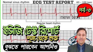 ECG TEST REPORT খুব সহজেই বুঝতে পারবেন পর্ব৩। CARDIAC AXIS । HEART RATE। HEART RHYTHM। RBBB। EKG [upl. by Drucy]