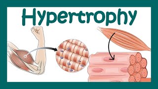 Hypertrophy  What is hypertrophy  Mechanism of muscle hypertrophy  How does hypertrophy happen [upl. by Asecnarf717]