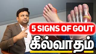 What is Gout  Dr Shriram krishnamoorthy  Tamil [upl. by Elin]