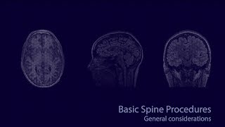 Basic neuroradiology procedures part 1  General considerations [upl. by Asilat163]