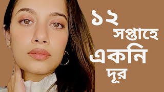 ১২ সপ্তাহে একনি দূর॥How to Remove Acne Differin Gel Review Bangla [upl. by Kussell]