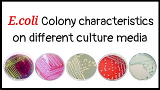 Colony characteristics of E coli on different culture media  EMB  MacConkey  NAM  BA  Hicrome [upl. by Hornstein]