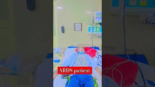 What is ARDS Acute Respiratory Distress Syndrome [upl. by Guidotti304]